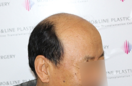 치료후기 이미지